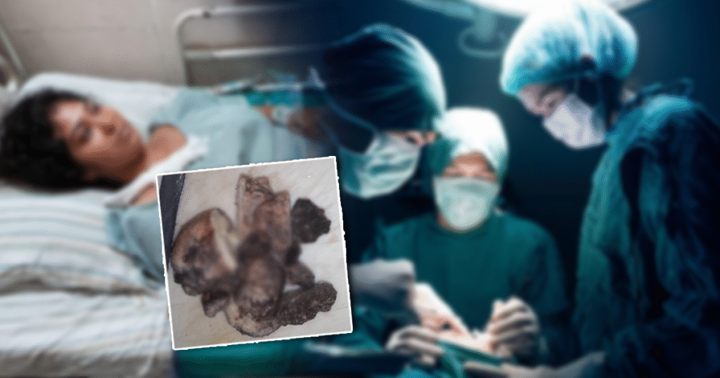 රෝහලට ඇතුල් කල මවකගේ කුස තුල තිබී හමුවූ දේ | වෛද්‍යවරුන්ගේ පවා ඇස් උඩ යයි